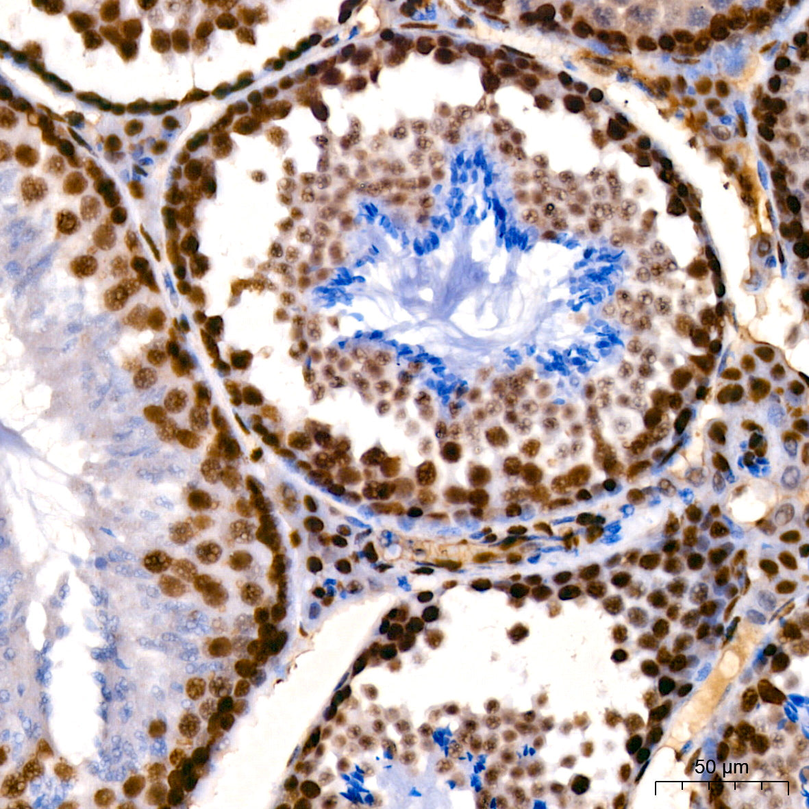 [KO Validated] HMGB1 Rabbit mAb