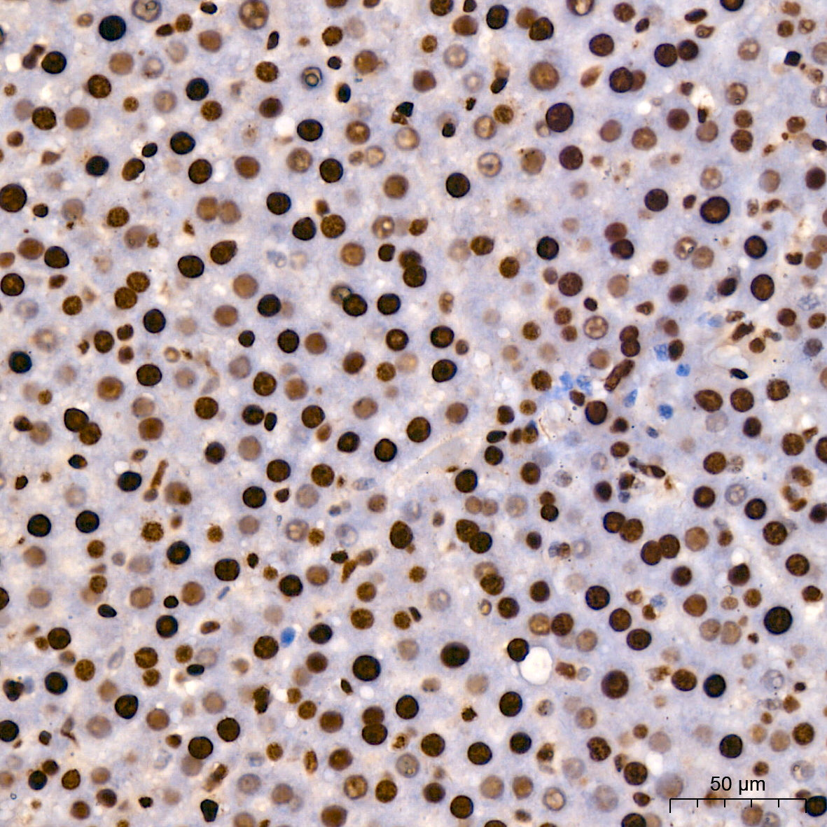 [KO Validated] HMGB1 Rabbit mAb