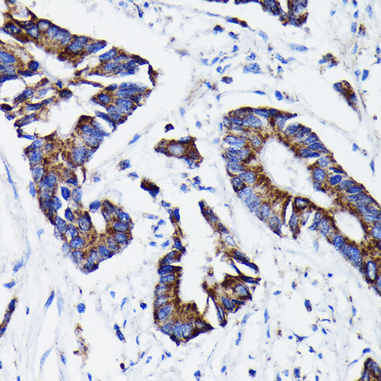 Prohibitin Rabbit mAb