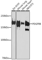 PDGFRB Rabbit mAb