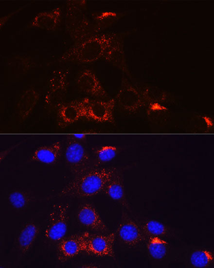 PDGFRB Rabbit mAb