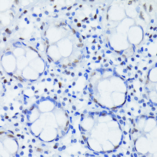 HIF1β/ARNT Rabbit mAb