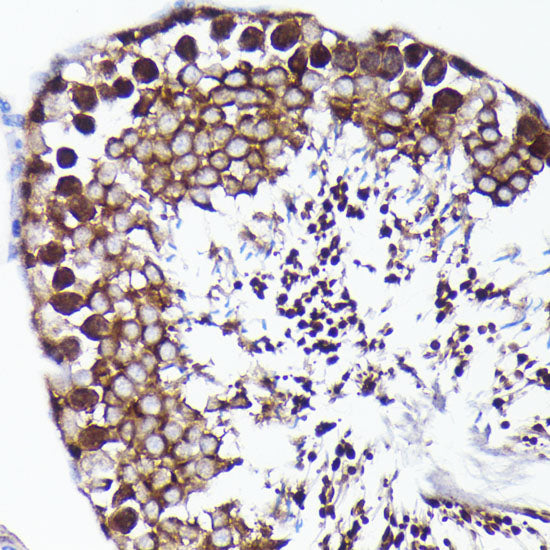 PRMT5 Rabbit mAb