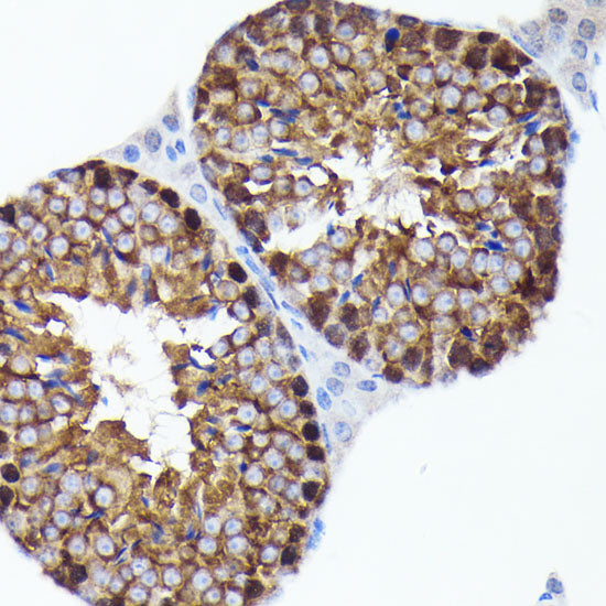PRMT5 Rabbit mAb