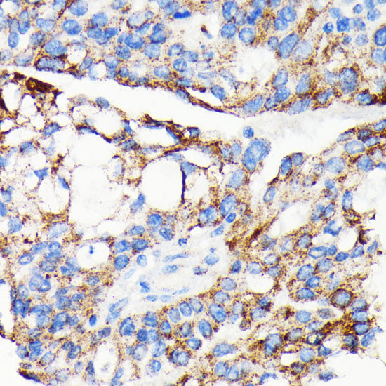 AIF Rabbit mAb