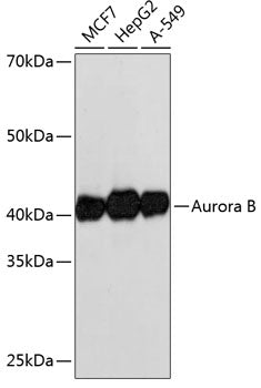 Aurora B Rabbit mAb