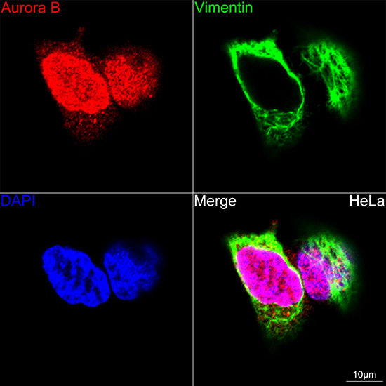 Aurora B Rabbit mAb