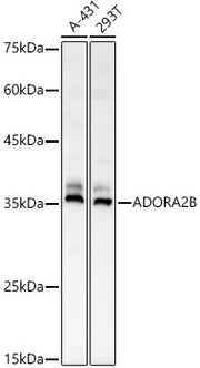 ADORA2B Rabbit pAb