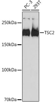 TSC2 Rabbit mAb