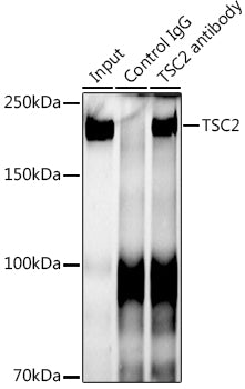 TSC2 Rabbit mAb