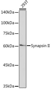 Synapsin II Rabbit mAb
