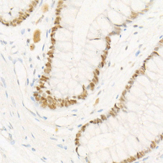 Chk2 Rabbit mAb