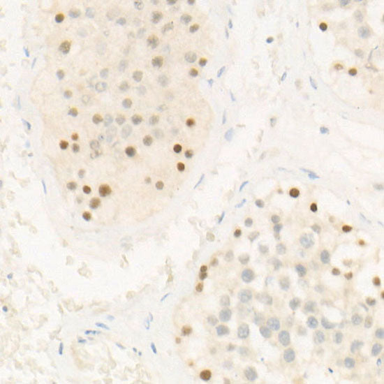 Chk2 Rabbit mAb
