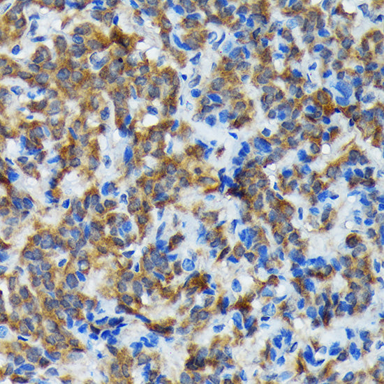 Thyroid Peroxidase Rabbit mAb