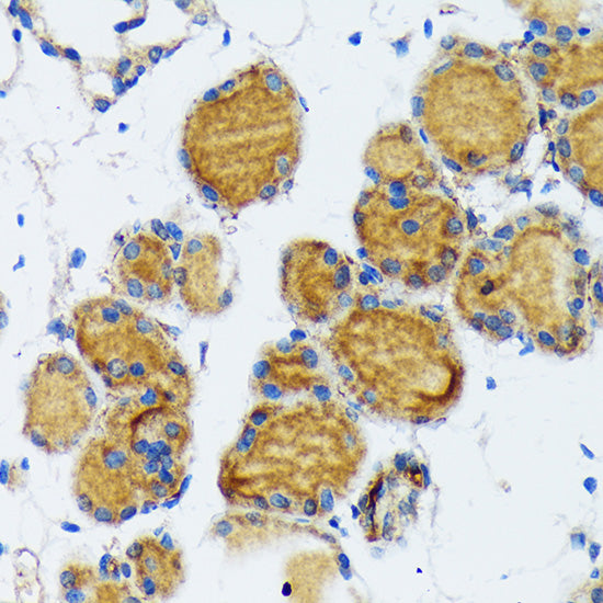 Thyroid Peroxidase Rabbit mAb
