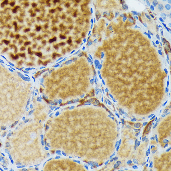 Thyroid Peroxidase Rabbit mAb