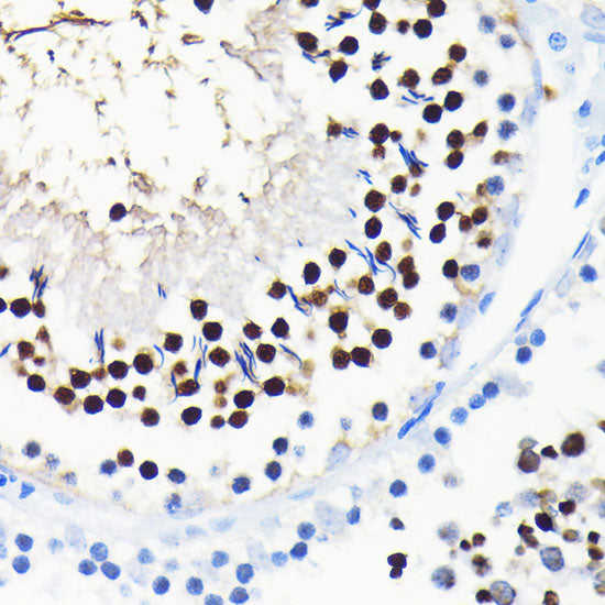 TCF4/TCF7L2 Rabbit mAb