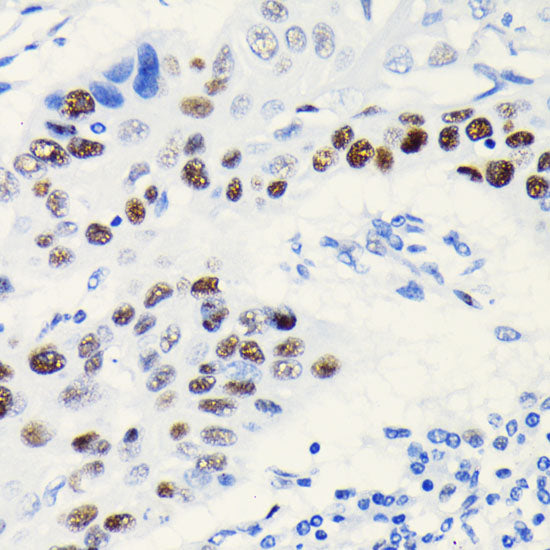 TCF4/TCF7L2 Rabbit mAb