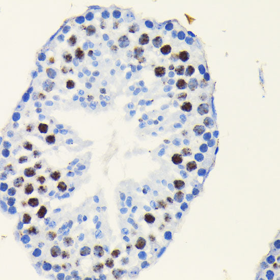 TCF4/TCF7L2 Rabbit mAb