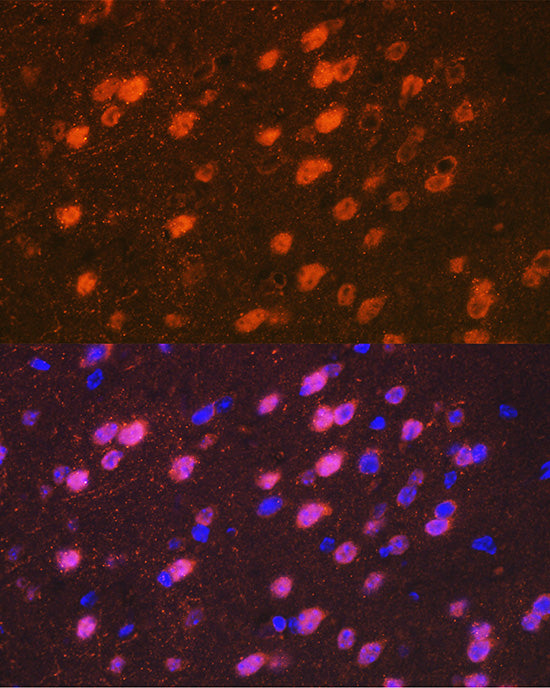TBR1 Rabbit mAb