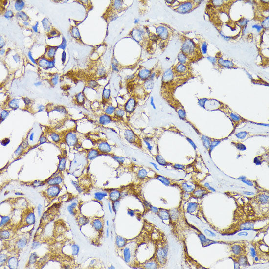 RARα Rabbit mAb