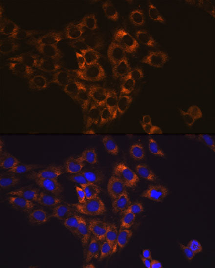 Caspase-6 Rabbit mAb