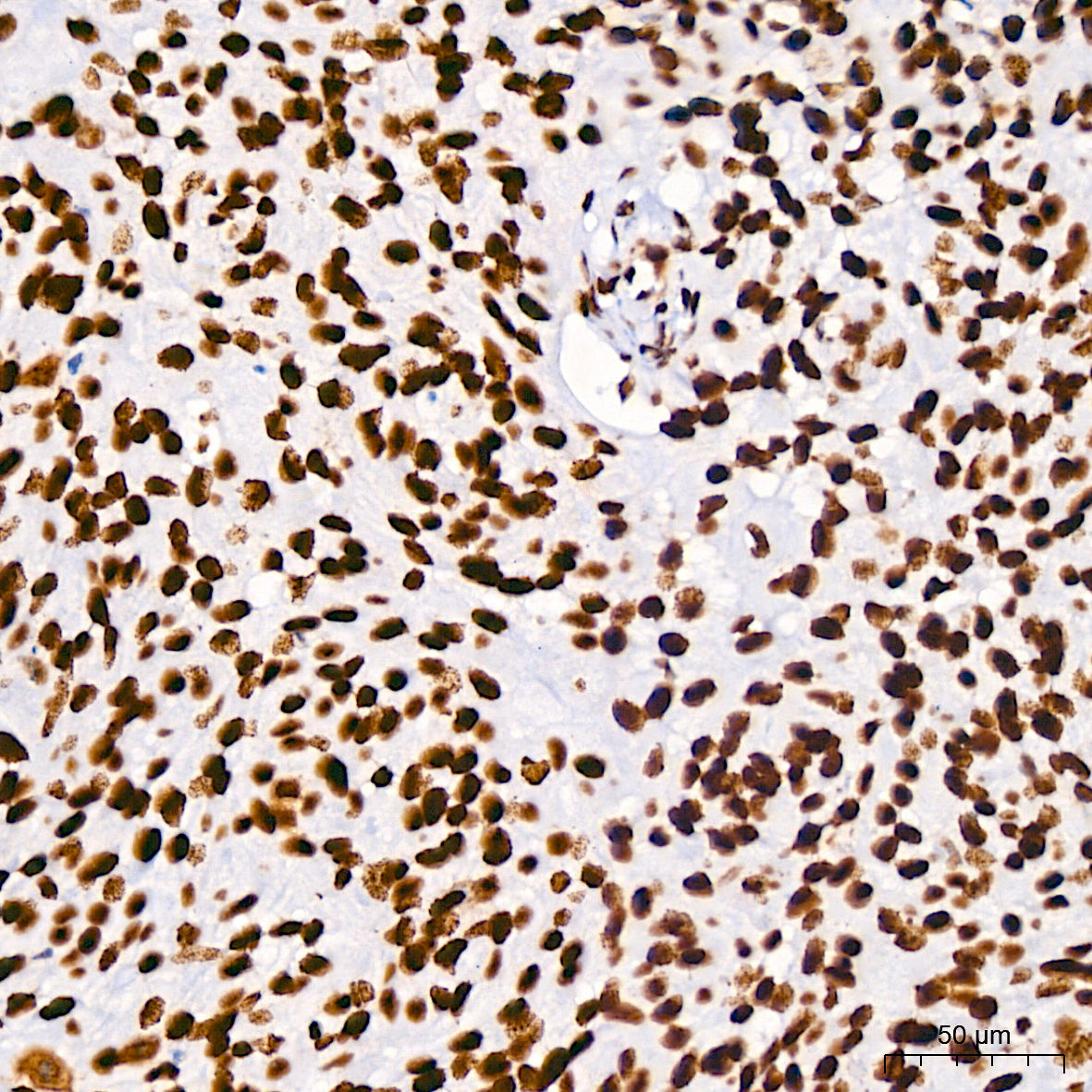 BRG1/SMARCA4 Rabbit mAb