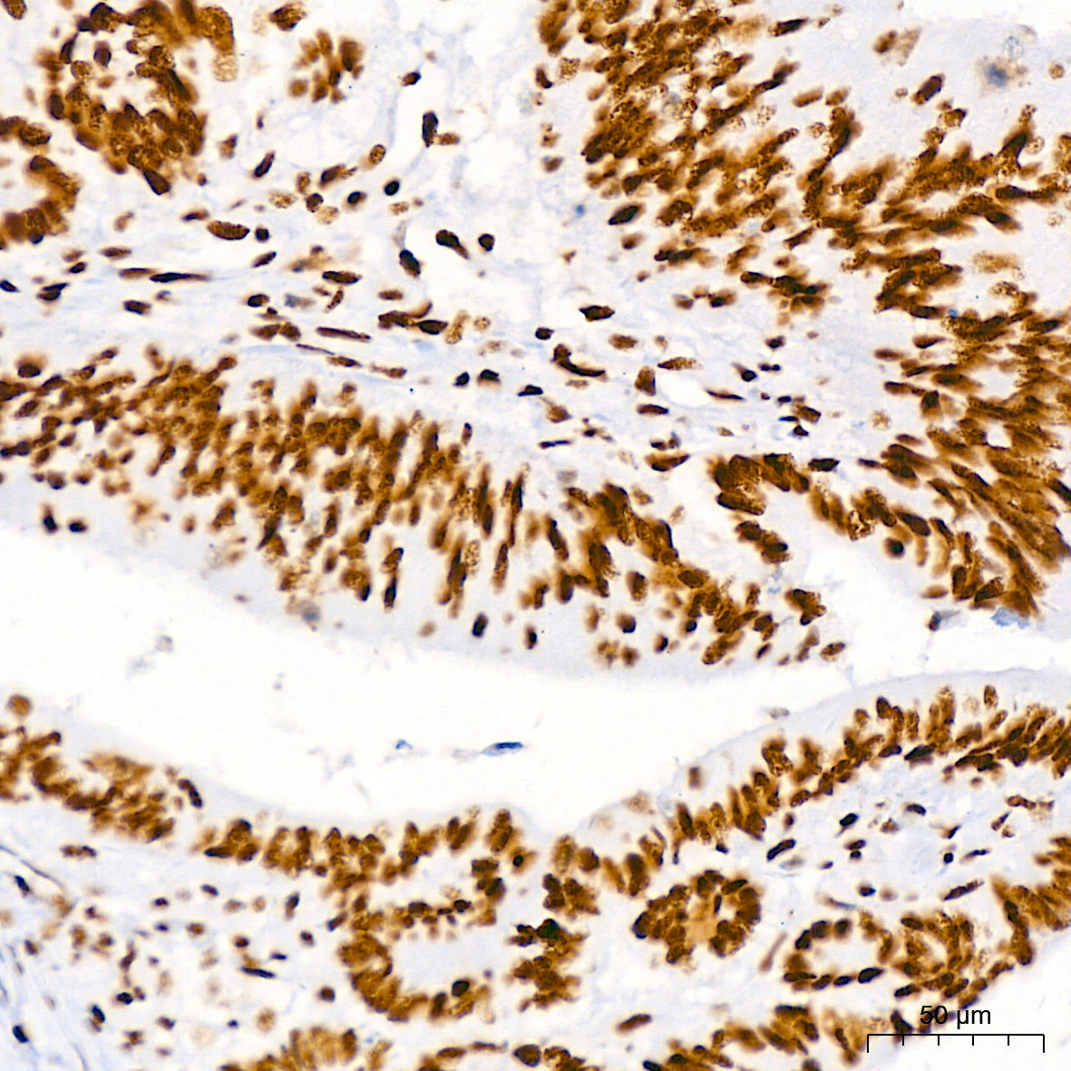 BRG1/SMARCA4 Rabbit mAb