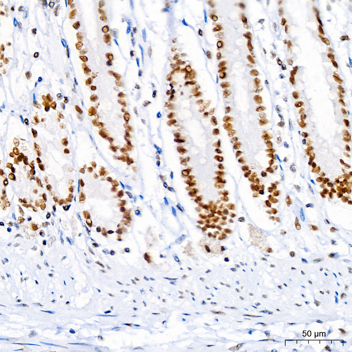 BRG1/SMARCA4 Rabbit mAb