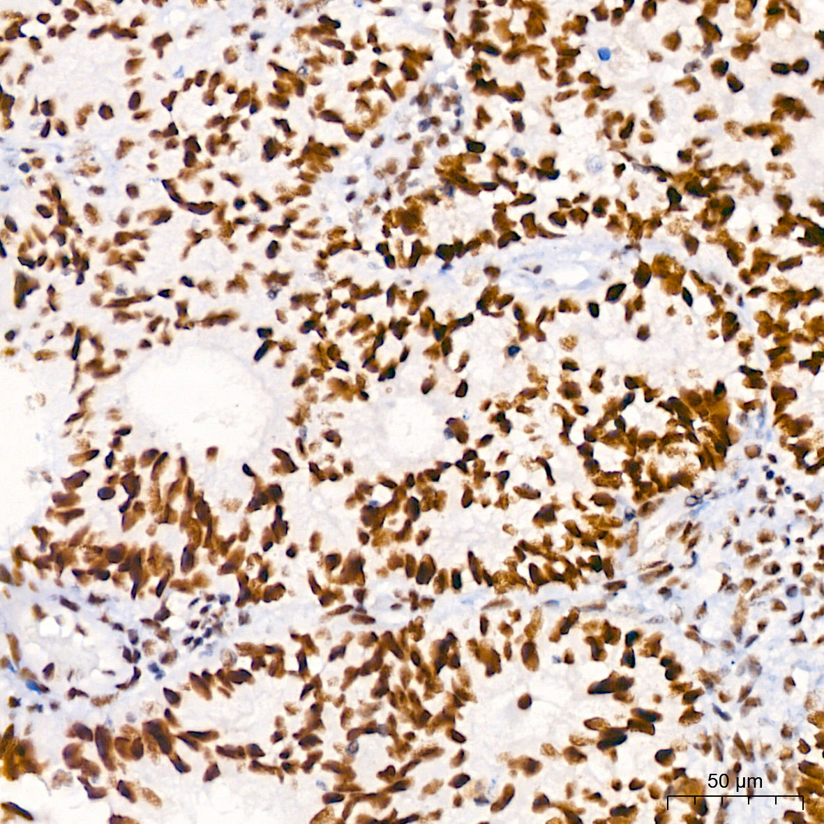 BRG1/SMARCA4 Rabbit mAb