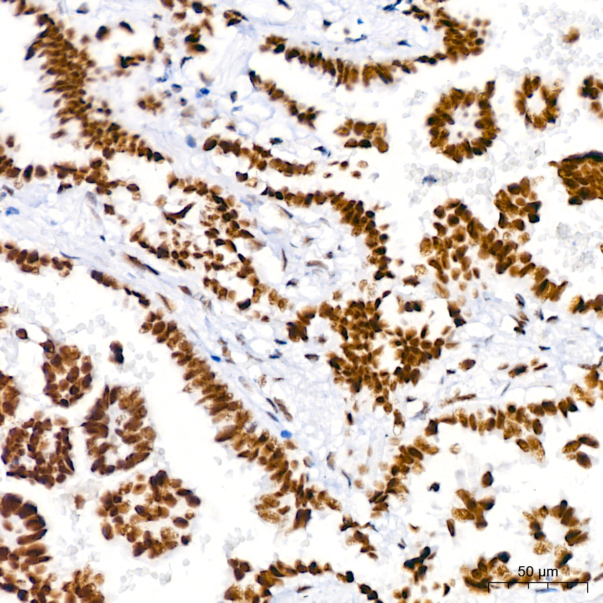 BRG1/SMARCA4 Rabbit mAb