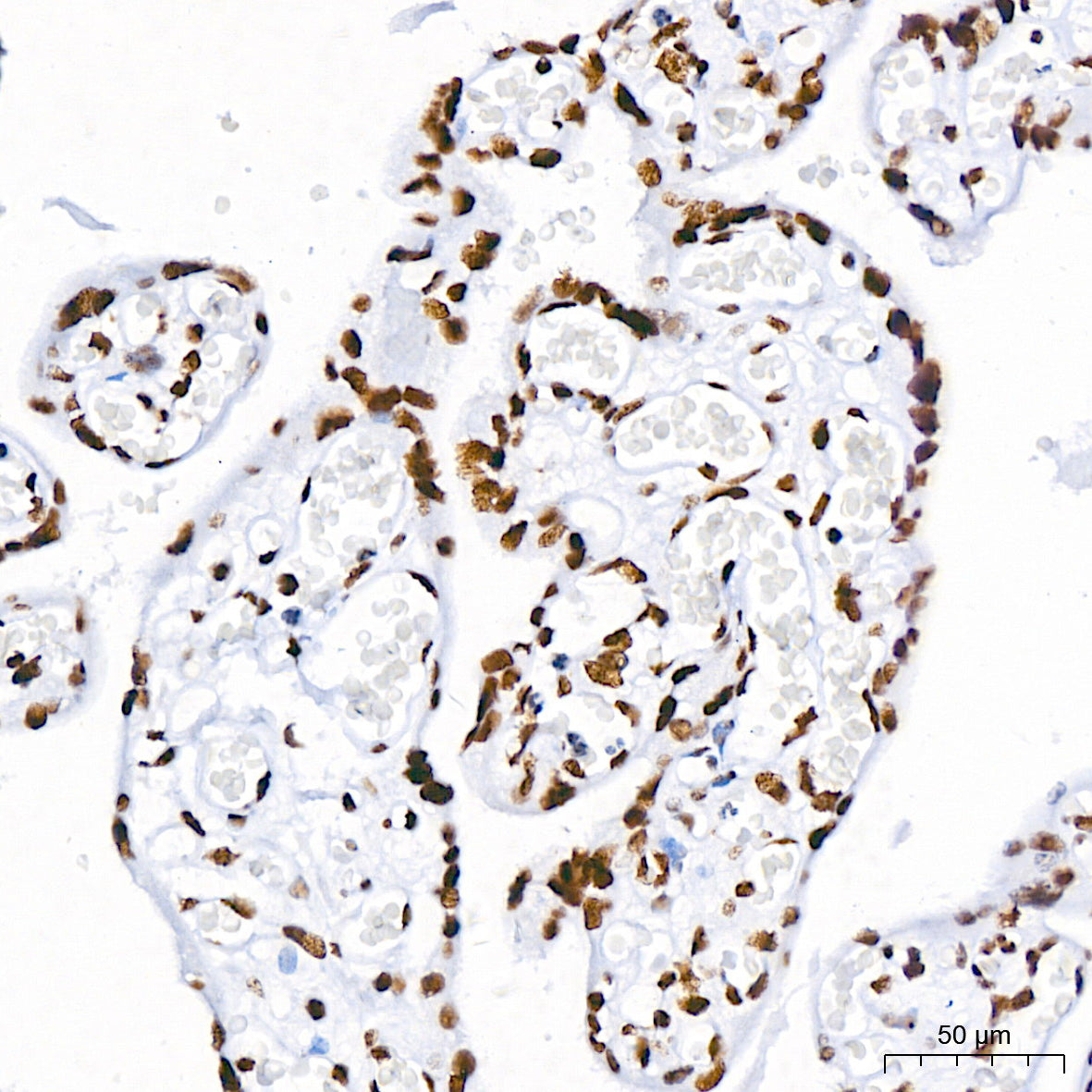 BRG1/SMARCA4 Rabbit mAb