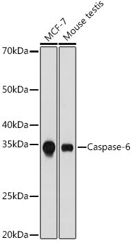 Caspase-6 Rabbit mAb