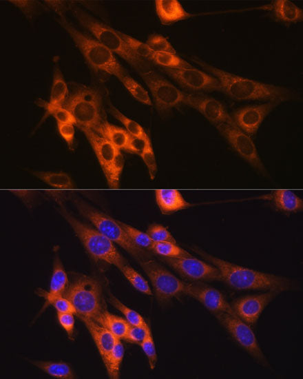 Caspase-6 Rabbit mAb