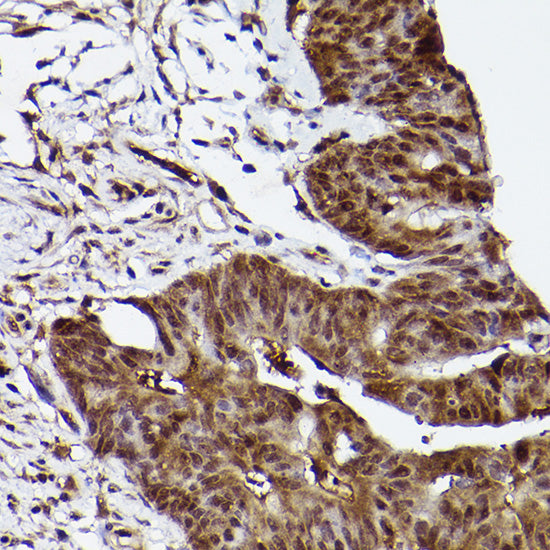 [KD Validated] ERK1 Rabbit mAb