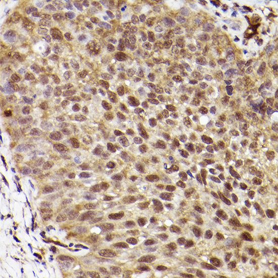[KD Validated] ERK1 Rabbit mAb