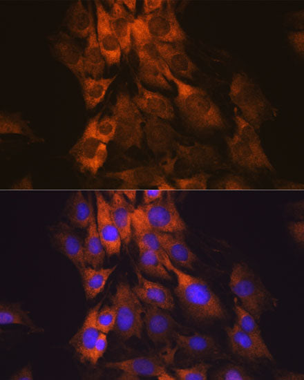 MEK1 Rabbit mAb
