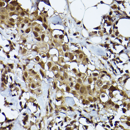 [KO Validated] STAT3 Rabbit mAb