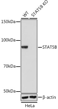 [KO Validated] STAT5B Rabbit mAb