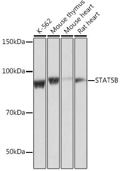 [KO Validated] STAT5B Rabbit mAb