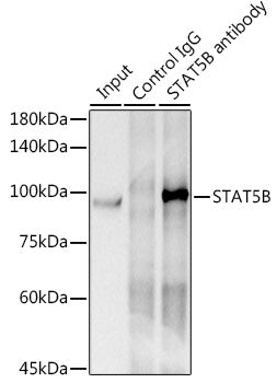 [KO Validated] STAT5B Rabbit mAb