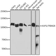 KAP1/TRIM28 Rabbit mAb