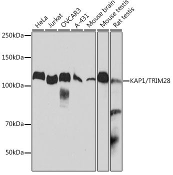 KAP1/TRIM28 Rabbit mAb