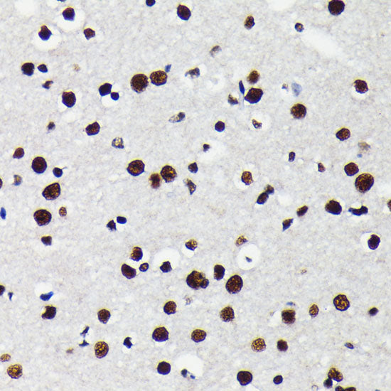 KAP1/TRIM28 Rabbit mAb
