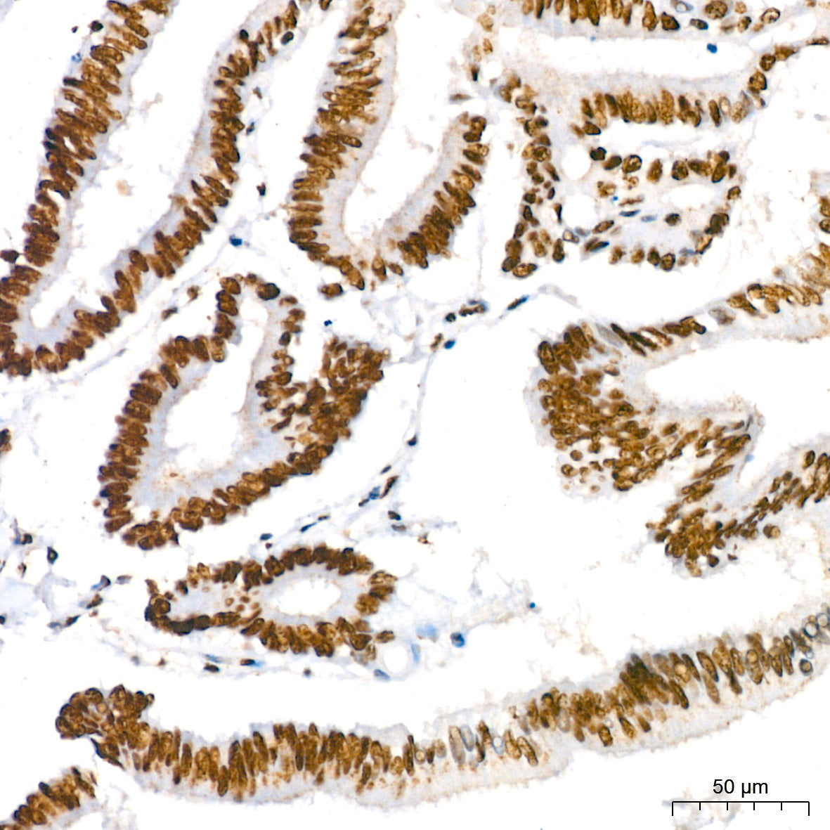 KAP1/TRIM28 Rabbit mAb