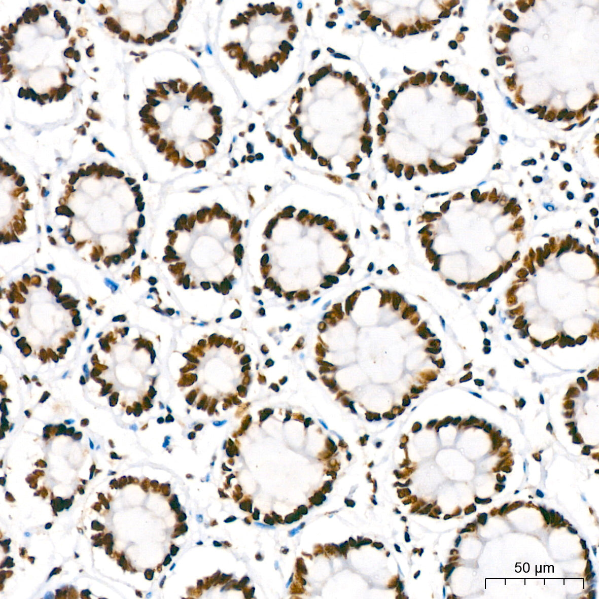 KAP1/TRIM28 Rabbit mAb