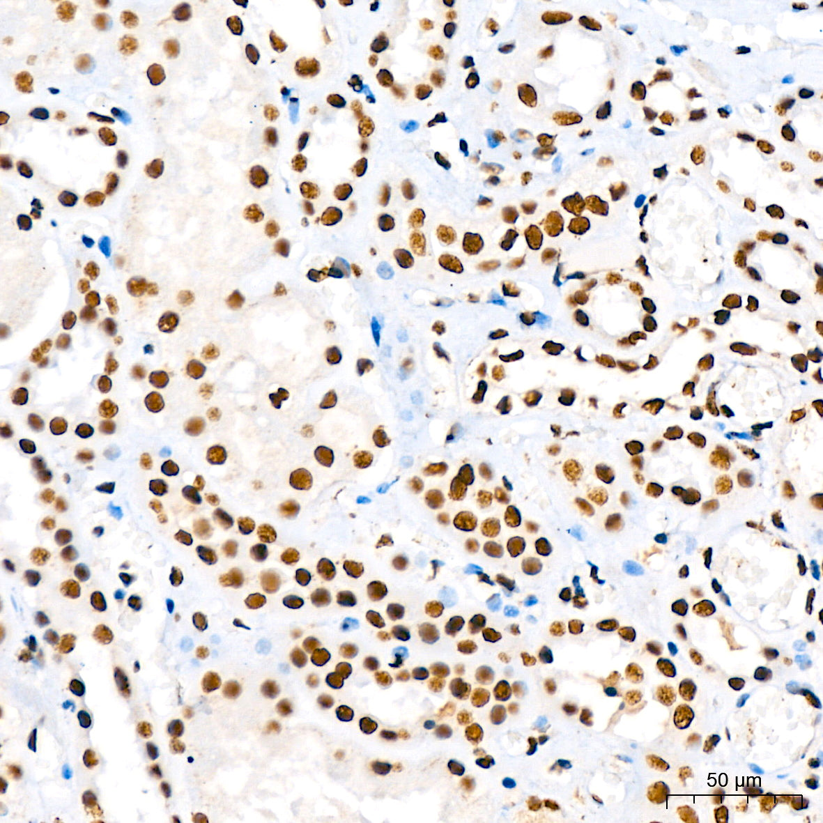 KAP1/TRIM28 Rabbit mAb