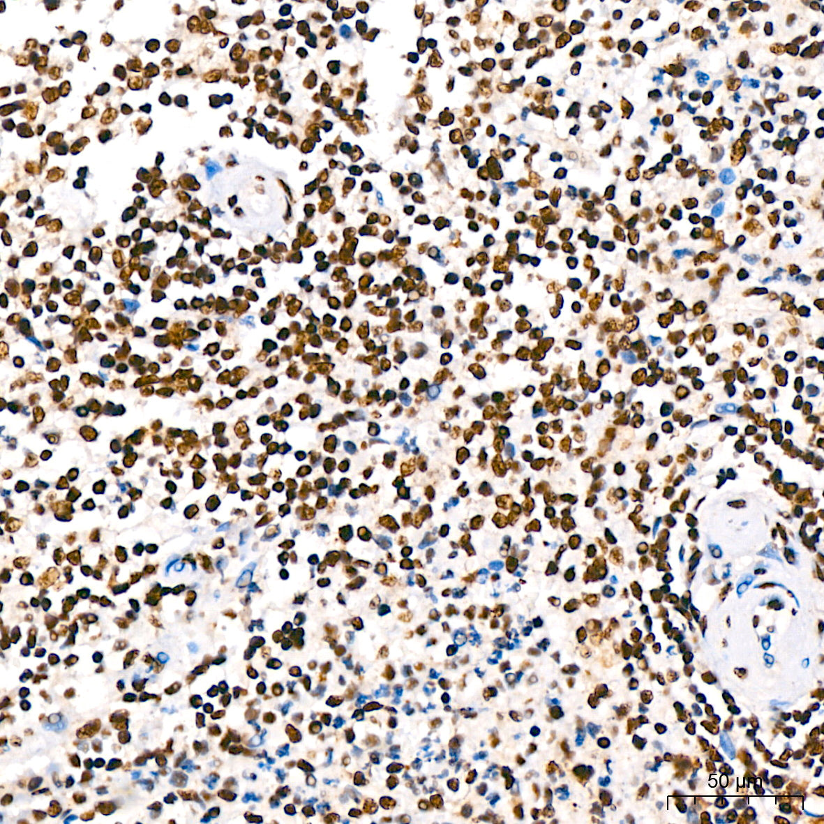 KAP1/TRIM28 Rabbit mAb