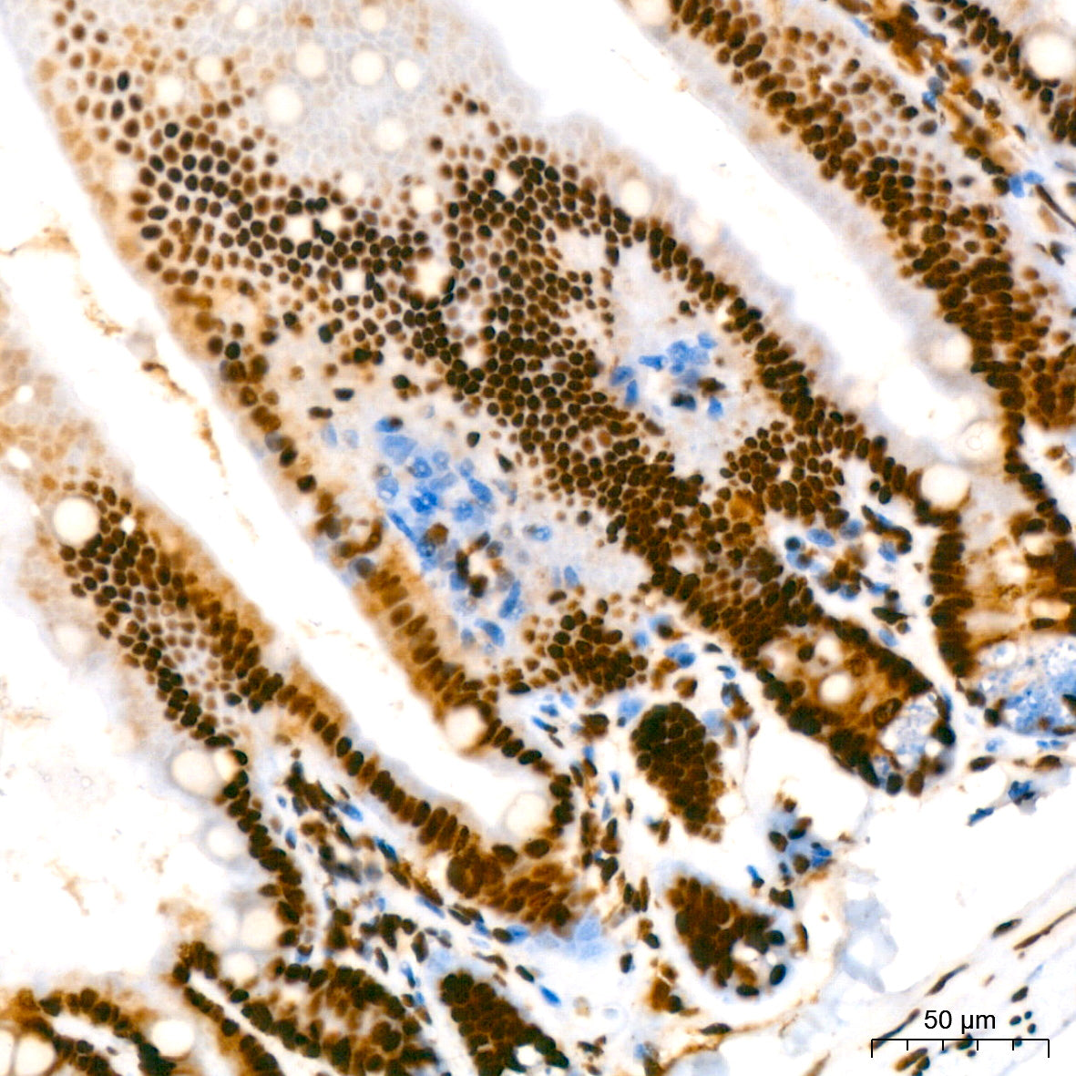 KAP1/TRIM28 Rabbit mAb