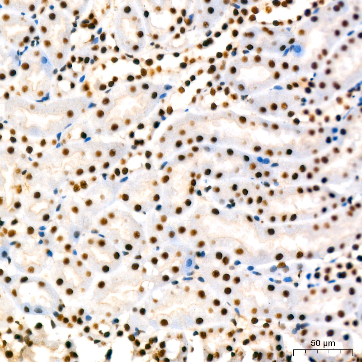 KAP1/TRIM28 Rabbit mAb